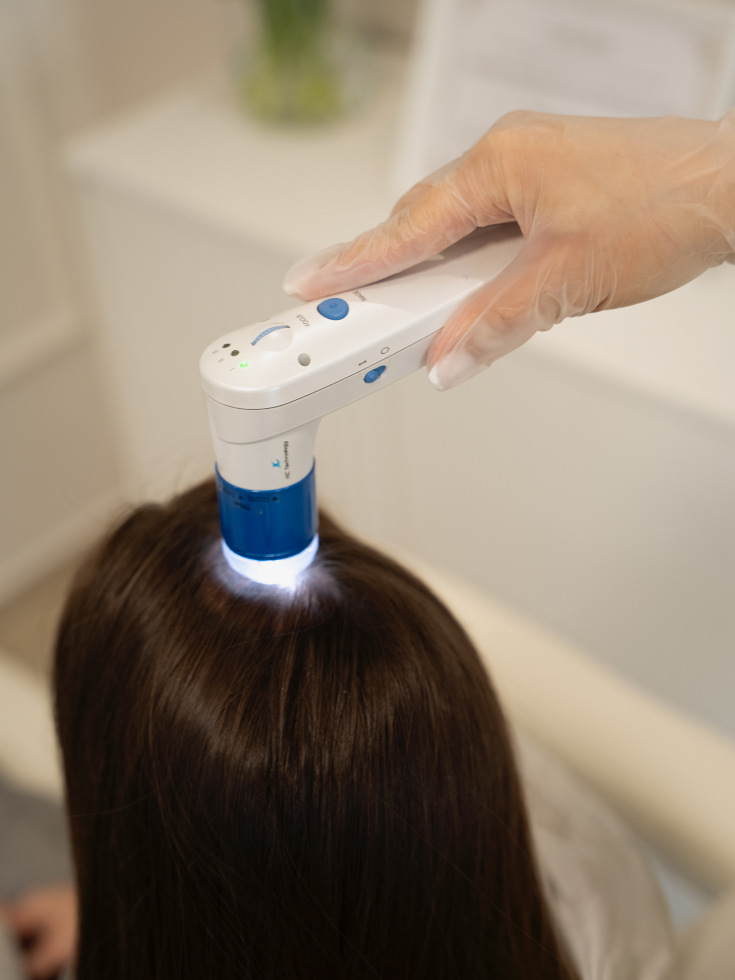 trichoskopia skory glowy